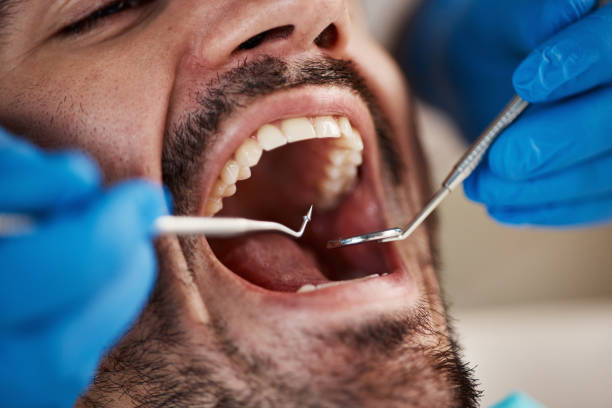 Best Broken or Chipped Tooth Repair in Fort Bliss, TX