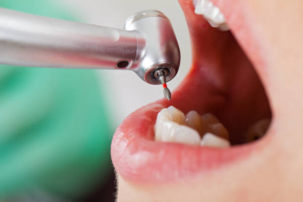 Best Urgent Dental Care for Toothaches in Fort Bliss, TX